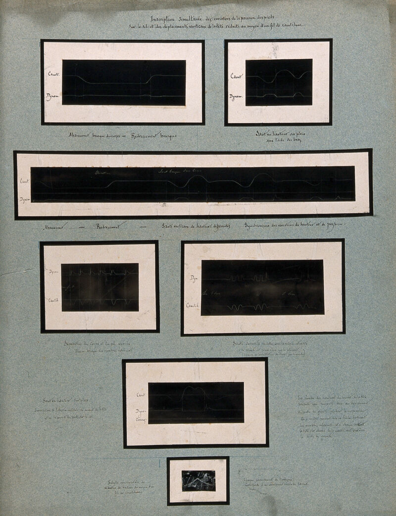 Variations of the pressure of feet on the ground and movements of the head, whilst running (?). Chart by Etienne-Jules Marey., 1800-1899, by Étienne-Jules Marey