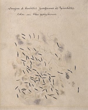 view Bacilli of tonsillitis (Vincent's angina). Drawing by H. Vincent.