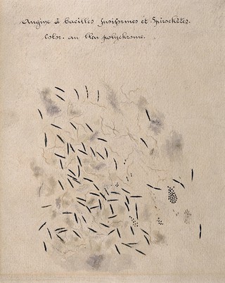 Bacilli of tonsillitis (Vincent's angina). Drawing by H. Vincent.