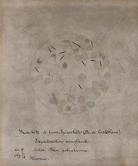 Fusobacteria observed in the bloody sputum of a patient with Castellani's bronchitis. Drawing by H. Vincent.