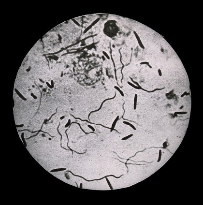 Fusiform bacillus, microscopic view. Photograph, [ca. 1930].
