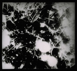 view Spirochetes Vincenti, microscopic view. Photograph, [ca. 1930].
