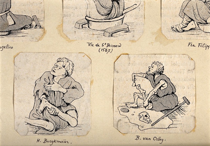 People with impaired arms and legs. Process prints., by Hans Burgkmair the Elder