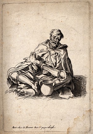 view A beggar crouching on the ground next to a jug holding his deformed left leg in his hands. Engraving.