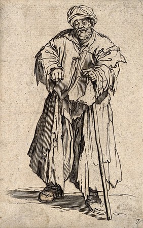 A bearded beggar dressed in rags holding a hat and a staff in his left hand. Etching with engraving possibly after J. Callot.