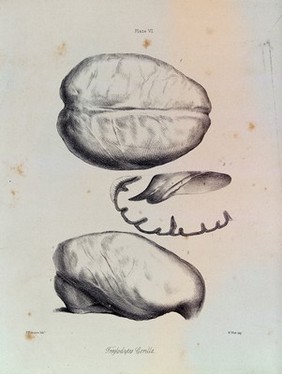 Three sections of a gorilla brain. Lithograph by F. Robinson, 1865.