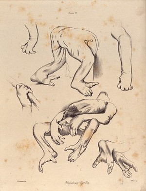 view The limbs, hands and feet of a male gorilla. Lithograph by F. Robinson, 1865, after J. Wolf.