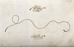 view A nematode worm. Coloured etching, ca. 1792.