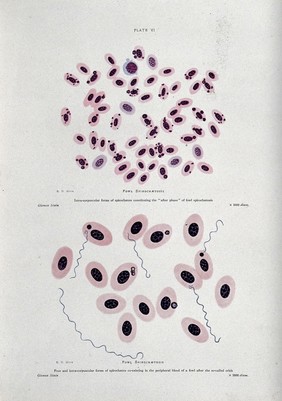 Spirochetes of fowl spirochetosis at 1000X (above) and 2000X (below) magnification. Coloured process print after R.D. Muir.