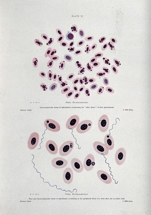 view Spirochetes of fowl spirochetosis at 1000X (above) and 2000X (below) magnification. Coloured process print after R.D. Muir.