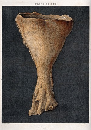 view Geology: fossil remains of a coral (Alcyonium). Coloured engraving by S. Springsguth after M. Sheffield.