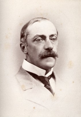 Sir William Bartlett Dalby. Photograph by G. Jerrard, 1881.