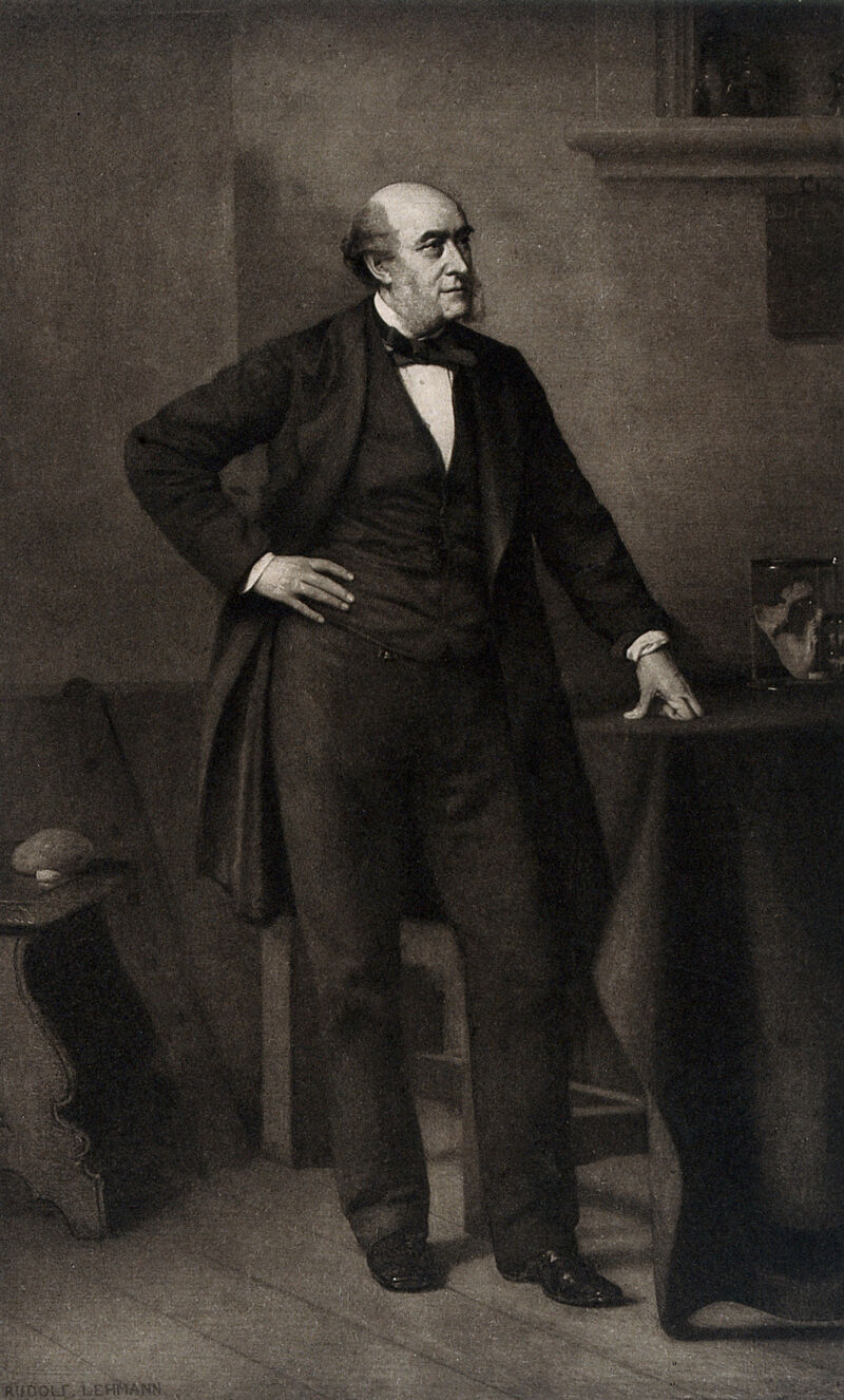 Sir William Fergusson. Photogravure after Rudolf Lehmann., by Rudolf Lehmann