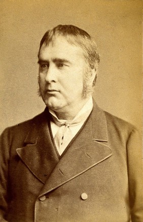 Sir William Withey Gull. Photograph.