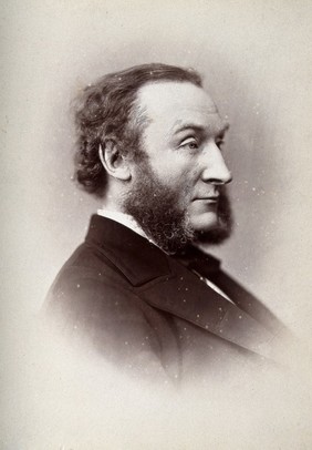 Frederick William Pavy. Photograph by G. Jerrard, 1881.