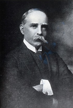 Sir Robert William Philip. Photograph.