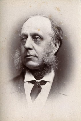 Sir William Overend Priestley. Photograph by G. Jerrard, 1881.