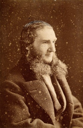 Sir Alexander Russell Simpson. Photograph by John Moffat.