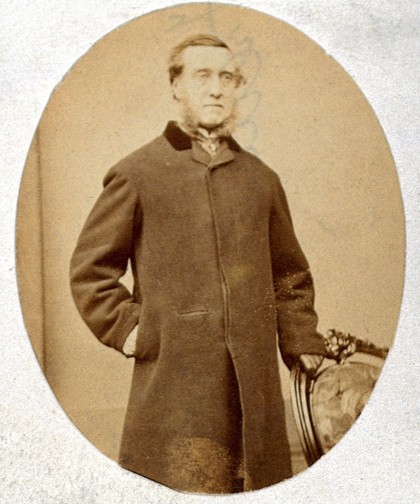 James Spence. Photograph.