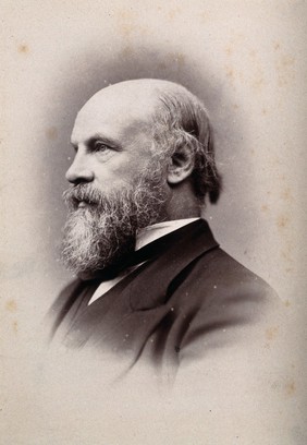 Sir William Turner. Photograph by G. Jerrard, 1881.