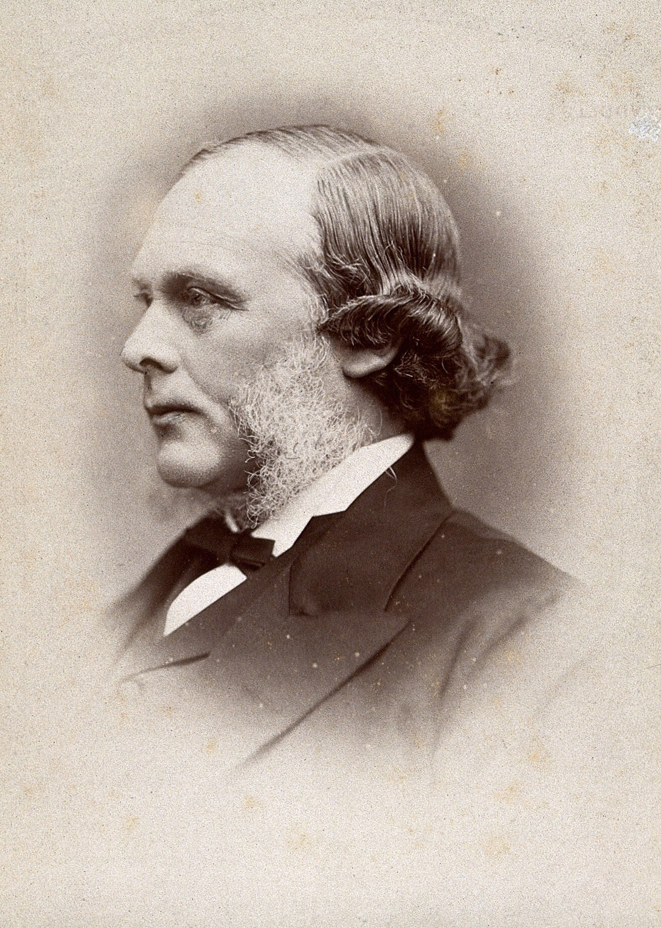 Joseph Lister, Baron Lister. Photograph by G. Jerrard, 1881.