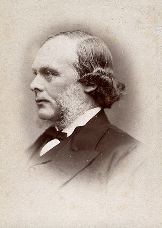 Joseph Lister, Baron Lister. Photograph by G. Jerrard, 1881.