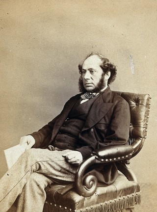 Thomas Nunneley. Photograph by Ernest Edwards, 1868.