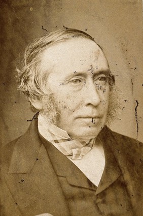 James Syme. Photograph by John Moffat.