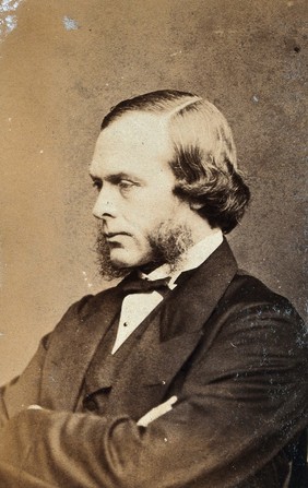 Sir Joseph Lister, Baron Lister. Photograph.