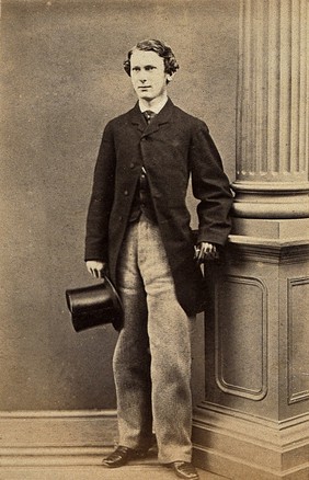 Albert Vickers. Photograph, Paris, 1863.