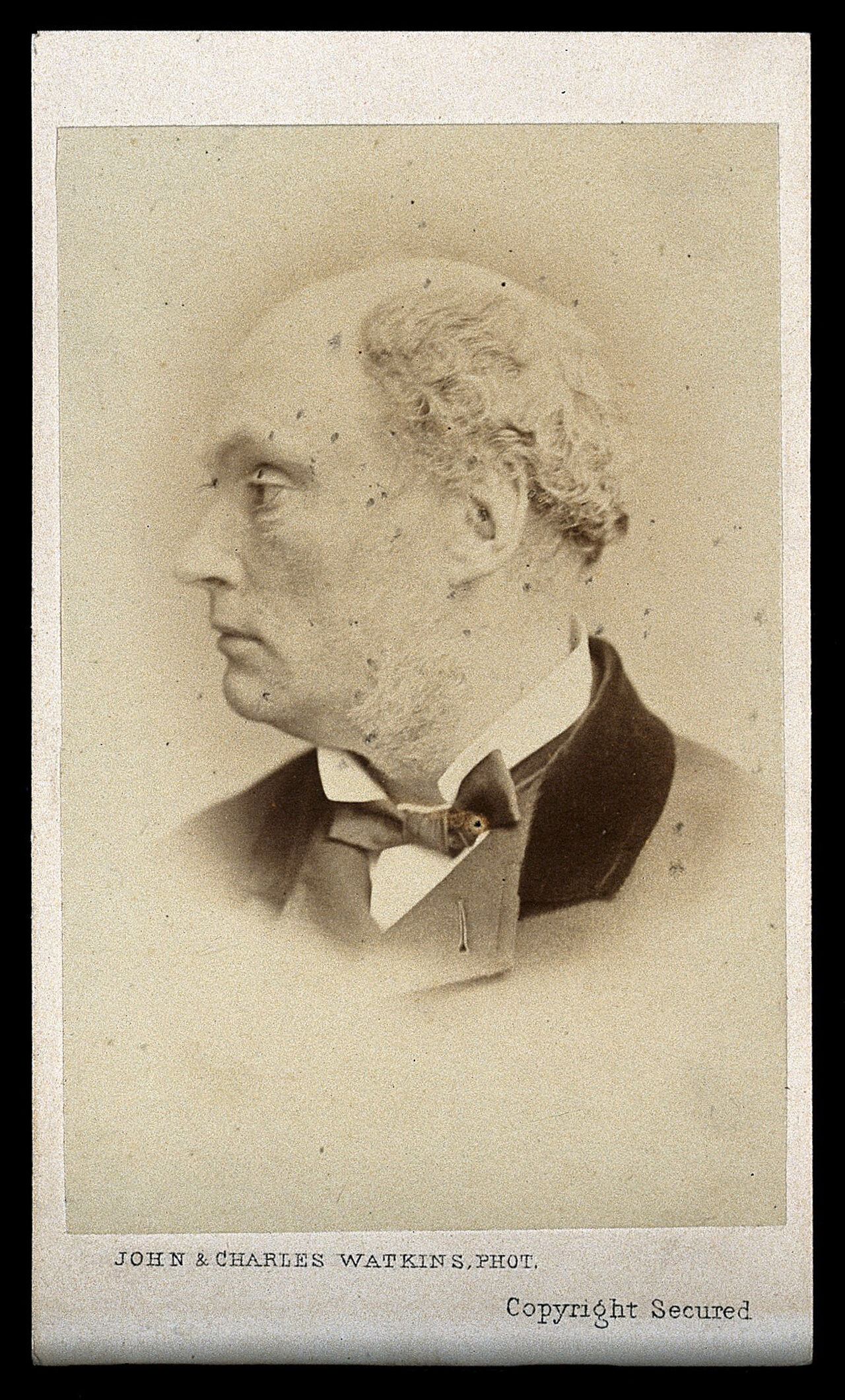 Daniel Maclise. Photograph by John & Charles Watkins., by John Watkins