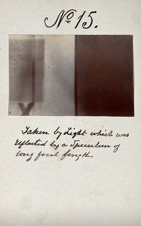 Light emitted by Röntgen Ray Tubes, reflected by a speculum. Photoprint from radiograph, by James Wimshurst, 1898.