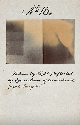 Light emitted by Röntgen Ray Tubes, reflected by a speculum. Photoprint from radiograph, by James Wimshurst, 1898.