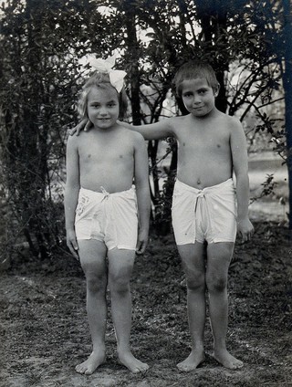 University Children's Hospital, Vienna: two children modelling seasonal clothing. Photograph, 1921.