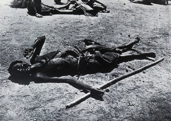 An inhabitant of Buruma Island, Uganda, suffering from sleeping sickness. Photograph, 1965, after photograph 1902.