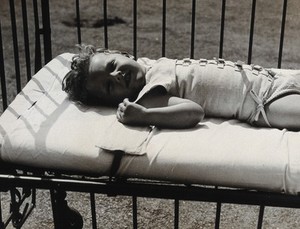 view St Nicholas' and St Martin's Orthopaedic Hospital, Pyrford, Surrey: smiling child patient in a cot. Photograph, c. 1935.