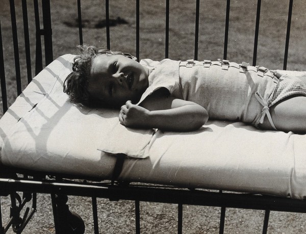 St Nicholas' and St Martin's Orthopaedic Hospital, Pyrford, Surrey: smiling child patient in a cot. Photograph, c. 1935.
