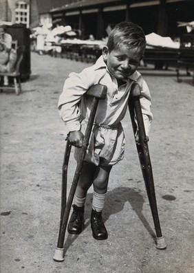 St Nicholas' and St Martin's Orthopaedic Hospital, Pyrford, Surrey: a boy using wooden crutches. Photograph, c. 1935.