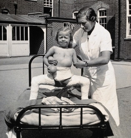 St Nicholas' and St Martin's Orthopaedic Hospital, Pyrford, Surrey: a girl in a plaster cast from the waist down, with a nurse supporting her. Photograph, c. 1935.