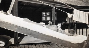 view St Nicholas' and St Martin's Orthopaedic Hospital, Pyrford, Surrey: a boy lying on a sloping bed outdoors, his legs in traction. Photograph, c. 1935.