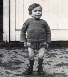 St Nicholas' and St Martin's Orthopaedic Hospital, Pyrford, Surrey: a small boy with bare legs, outdoors. Photograph, c. 1935.