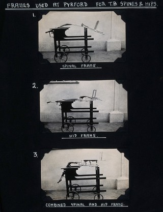 St Nicholas' and St Martin's Orthopaedic Hospital, Pyrford, Surrey: a portable wooden frame. Photograph, c. 1935.