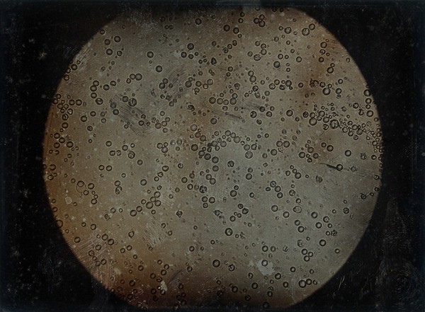 Human milk. Photomicrograph by Léon Foucault, 1844.