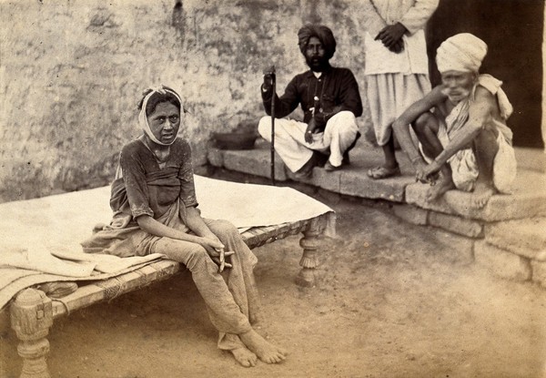 Female patient with bubonic plague in Karachi, India. Photograph, 1897.
