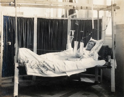 Military Hospital V.R. 76, Ris-Orangis, France: soldier with arm in traction, wounded in 1st world war. Photograph, 1916.