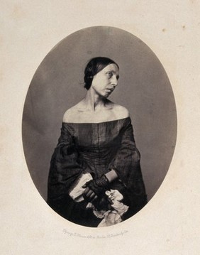 A woman viewed from the front with her head tilted towards left shoulder. Photograph by L. Haase after H.W. Berend, 1859.
