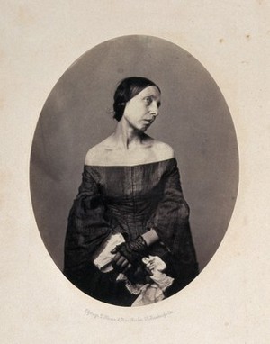 view A woman viewed from the front with her head tilted towards left shoulder. Photograph by L. Haase after H.W. Berend, 1859.