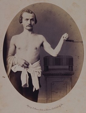 A man, viewed from the front and naked to waist, leaning on a cushion. Photograph by L. Haase, after H.W. Berend, 1859.