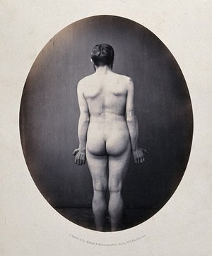 view A man, unclothed, viewed from behind in full-length, with semi-clenched fists. Photograph by L. Haase after H.W. Berend, 1860.