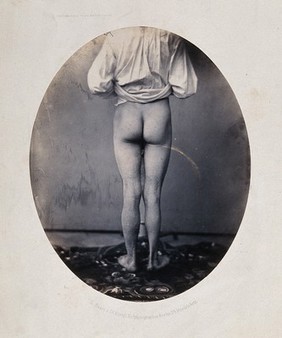 A man, viewed from behind, with naked legs and buttocks. Photograph by L. Haase after H.W. Berend, 1860.